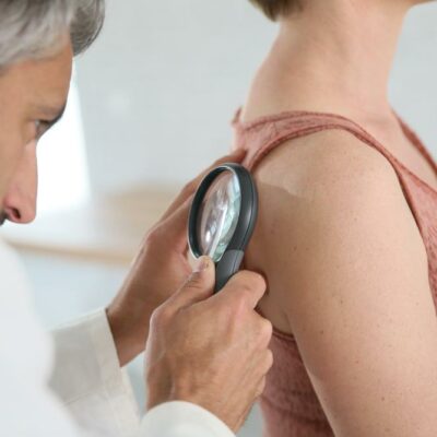 Treatments for Melanoma Skin Cancer