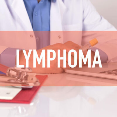 Lymphoma – Types, Causes, and Risk Factors